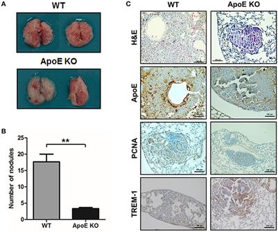 Inhibition of Lung Tumor Development in ApoE Knockout Mice via Enhancement of TREM-1 Dependent NK Cell Cytotoxicity